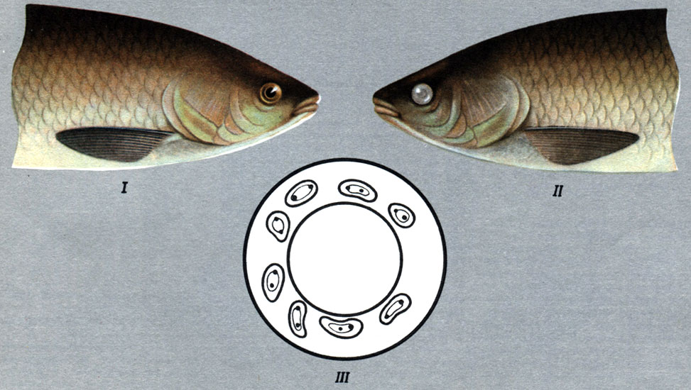 Диллостоматоз: I - здоровая рыба; ΙΙ - поражение глаза - бельмо (катаракта); III - метацеркарни в оболочке хрусталика